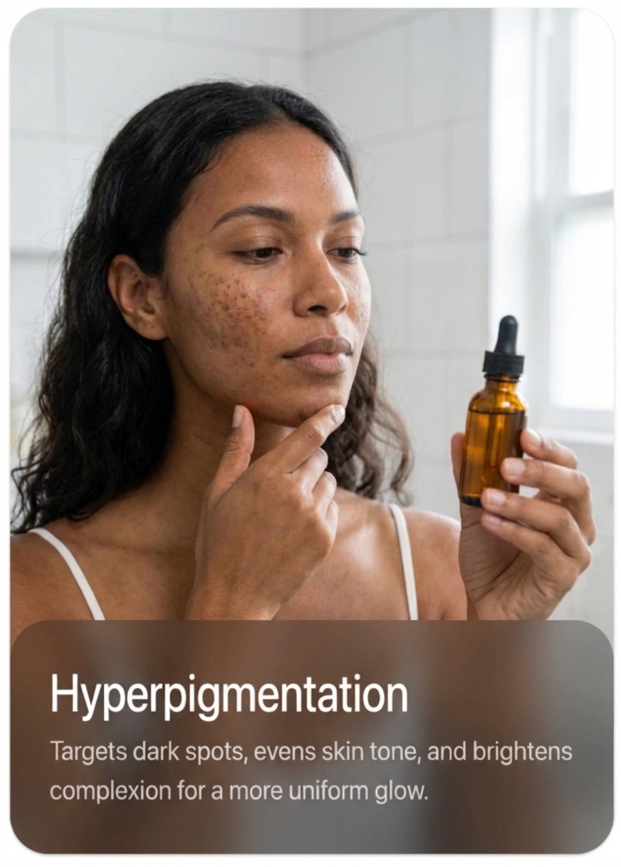 Hyperpigmentation